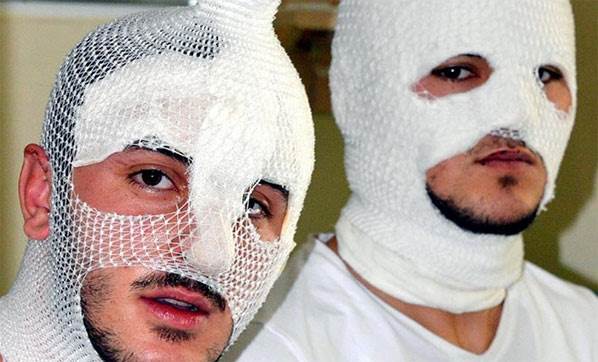 Onları bu hale neyin getirdiğine inanamayacaksınız