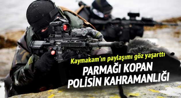Parmağı kopan polisten göz yaşartan kahramanlık