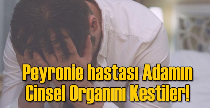 Peyronie hastası Adamın Cinsel Organını Kestiler!