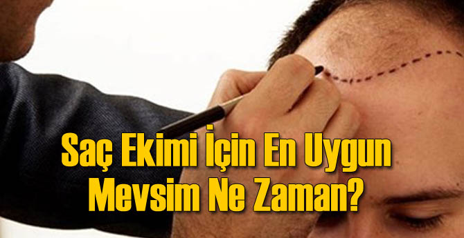 Saç Ekimi İçin En Uygun Mevsim Ne Zaman?