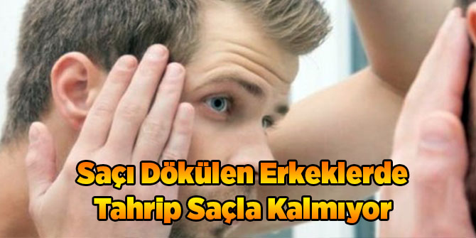 Saçı Dökülen Erkeklerde Tahrip Saçla Kalmıyor
