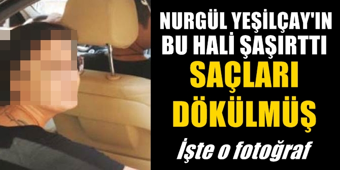 Saçları dökülmüş! Nurgül Yeşilçay'ın bu hali şaşırttı