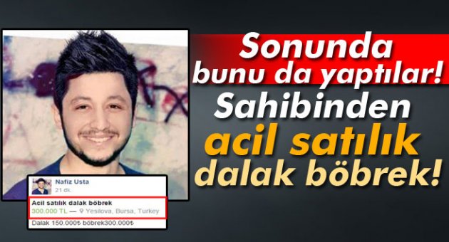 Sahibinden acil satılık dalak böbrek!
