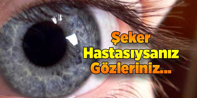 Şeker Hastasıysanız Gözleriniz...