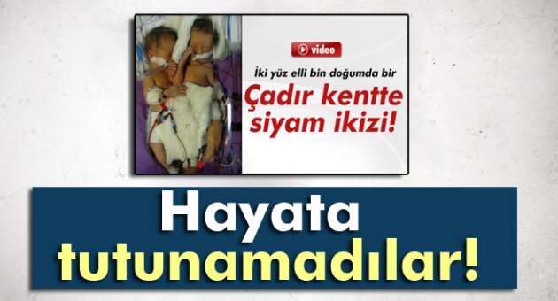 Siyam ikizler, hayata tutunamadı