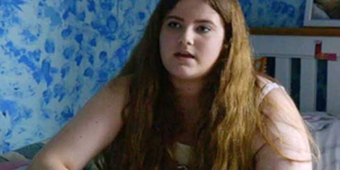 Şok Eden Rahatsızlık: Sol Kolu Hızla Büyüyor