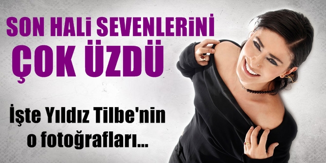 Son hali sevenlerini çok üzdü! İşte Yıldız Tilbe'nin o fotoğrafları