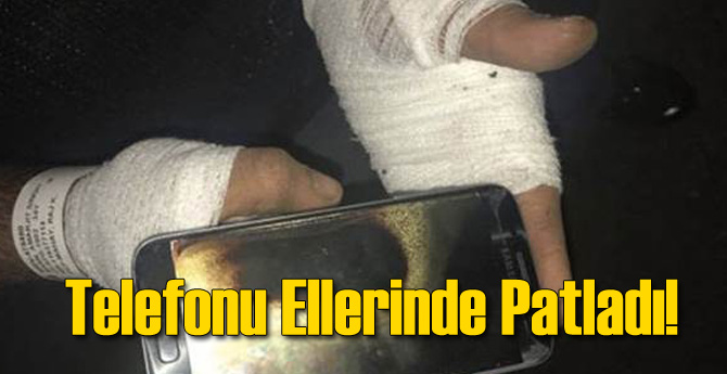 Telefonu Ellerinde Patladı!