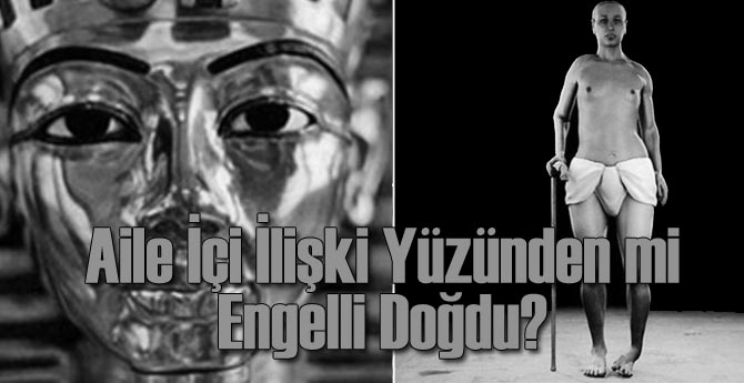 Tutankamon Aile İçi İlişkiden mi Engelli Doğdu?