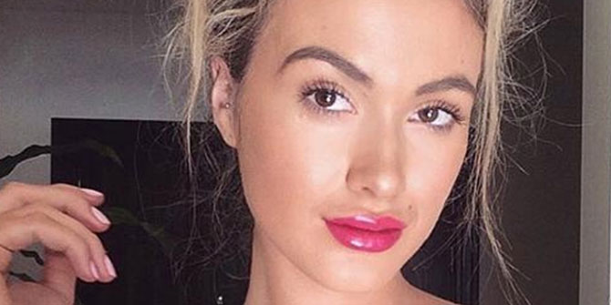 Ünlü Model Saldırıda Ağır Yaralandı!