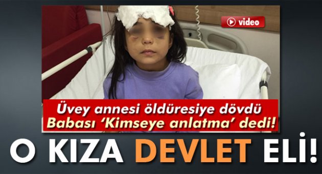 Üvey annesinin dövdüğü kız çocuğu devlet korumasına alınıyor