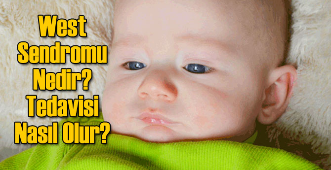West Sendromu Nedir? Tedavisi Nasıl Olur?