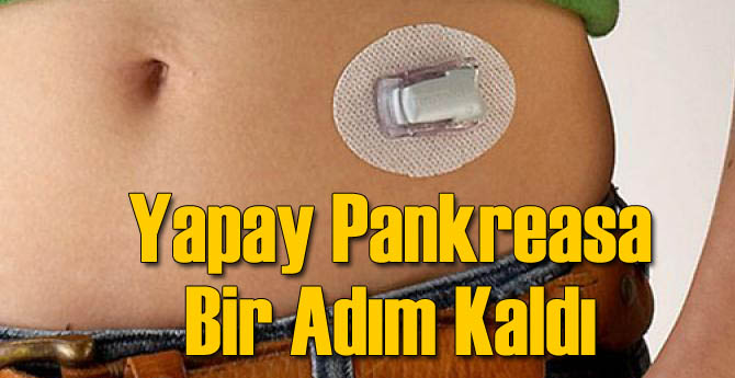 Yapay Pankreasa Bir Adım Kaldı