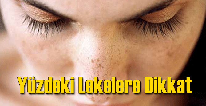Yüz Lekelerinde Tehlikeye Dikkat