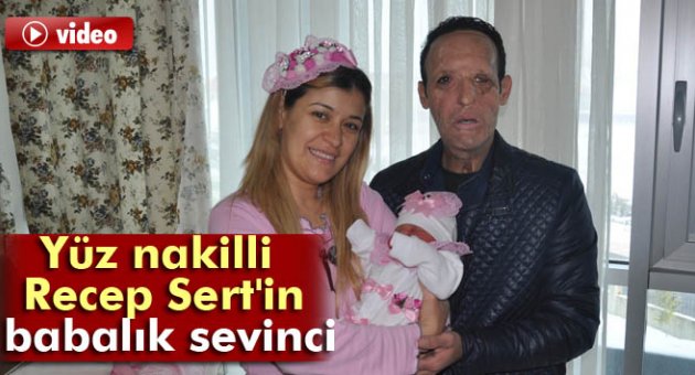 Yuz Nakli Olan Recep Sert In Babalik Sevinci Gundem Ege Politik Yuz Nakli Olan Recep Sert In Babalik Sevinci Gundem Ege Politik