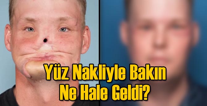 Yüz Nakliyle Tüm İzler Silindi...