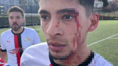 Maç sonrası saha içi savaş alanına döndü, 3 futbolcu hastanelik oldu