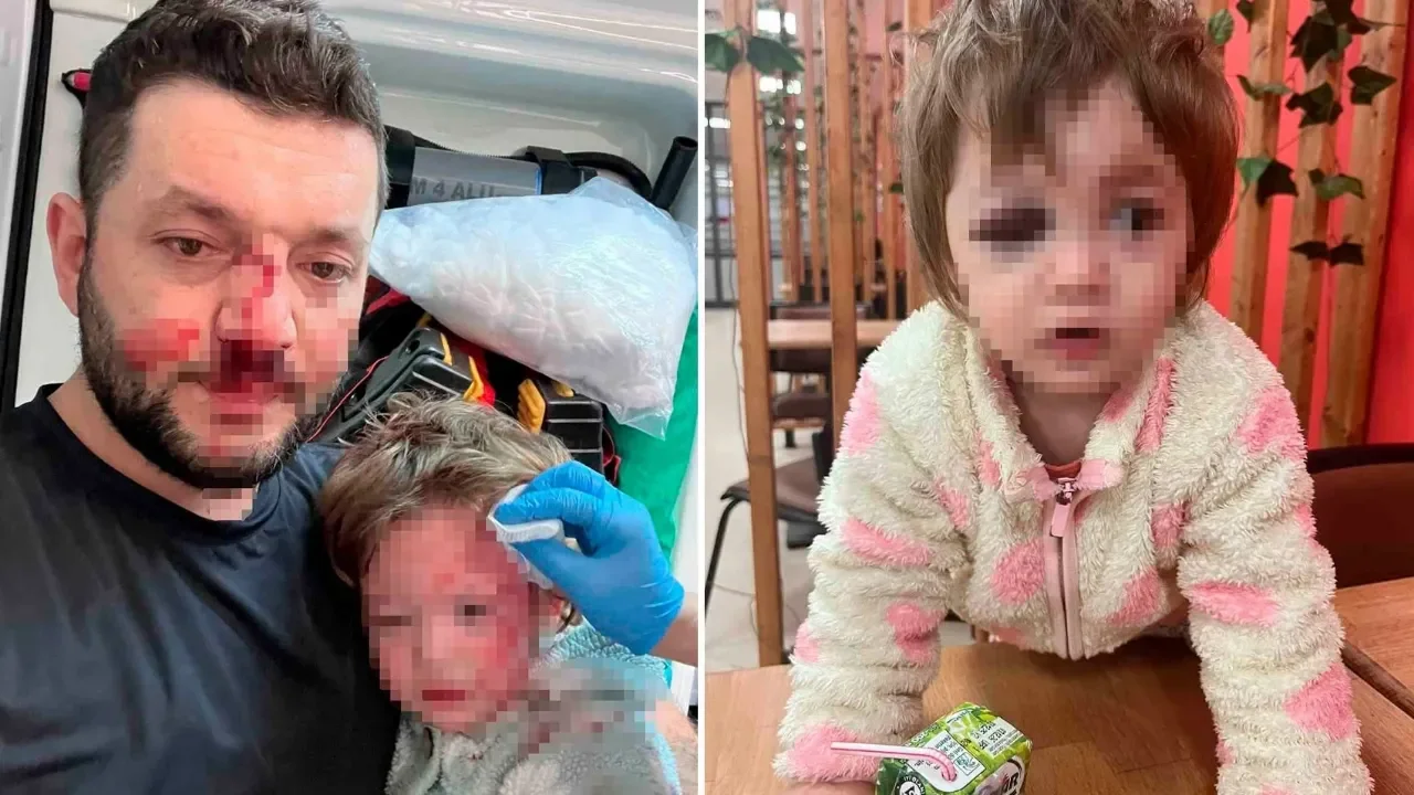 Yalova'da komşu dehşeti: 14 aylık bebeğiyle sopalı saldırıya uğrayan baba konuştu