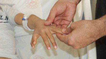 Şırnak’ta yapışık parmaklı iki kardeş ameliyatla sağlıklarına kavuştu