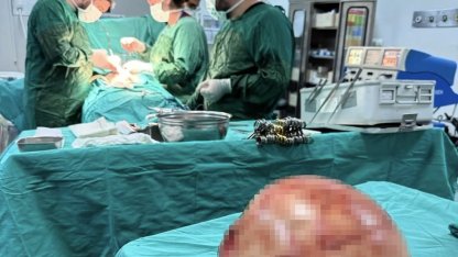 Van’da bir kadının karnından 35 santimetrelik dev kitle çıkarıldı