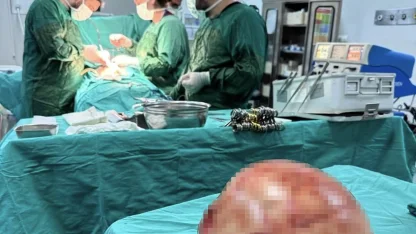 Van’da bir kadının karnından 35 santimetrelik dev kitle çıkarıldı