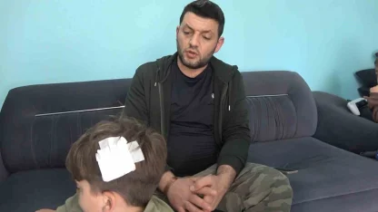 Yalova’daki komşu kavgasında bu kez 8 yaşındaki çocuğa taşlı saldırı