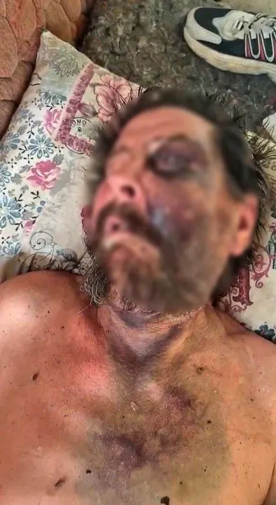 Gümüldür'de insanlık dramı: Darp edilen adamı metruk binaya atıp ölüme terk ettiler